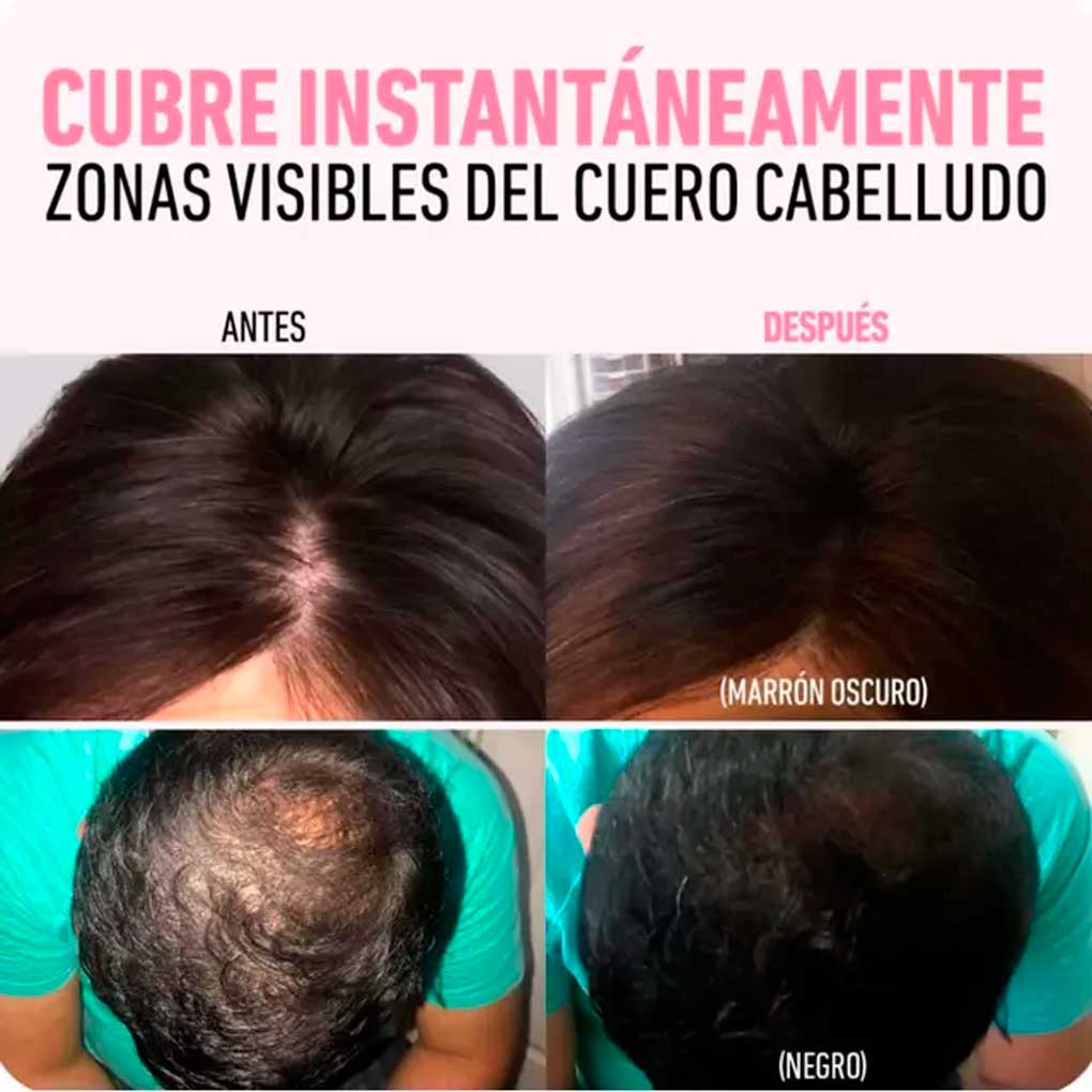 Relleno Capilar Instantáneo Calvicie