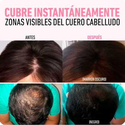 Relleno Capilar Instantáneo Calvicie