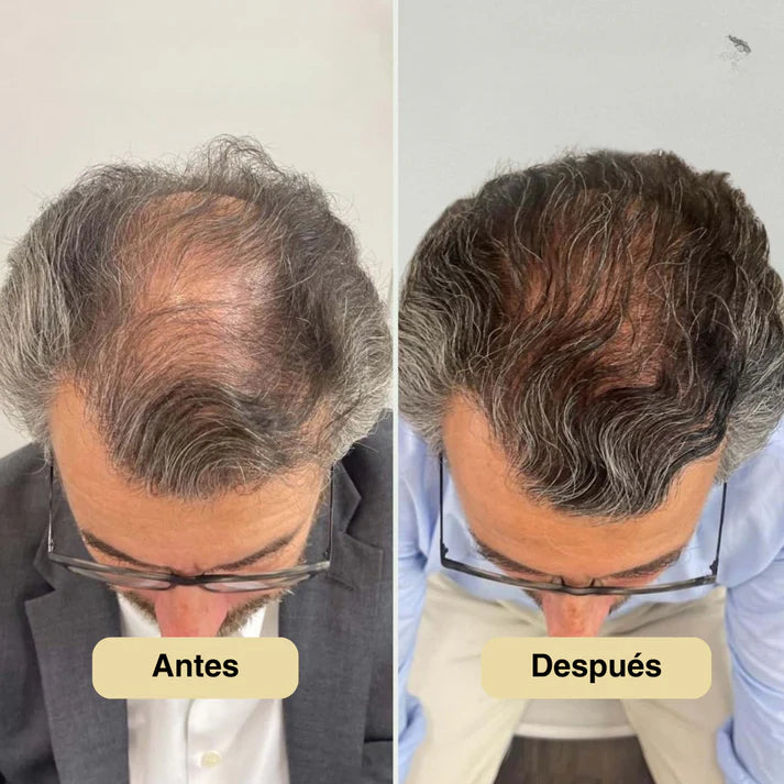 Sérum Crecimiento Capilar 25ML Rosemary