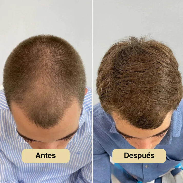 Sérum Crecimiento Capilar 25ML Rosemary