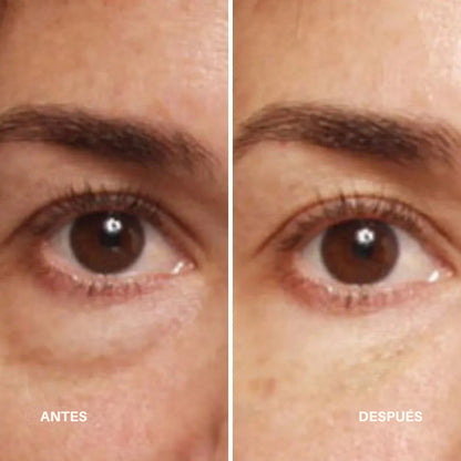 Anti-Ojeras Mirada Firme Instantánea