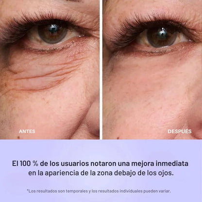 Anti-Ojeras Mirada Firme Instantánea