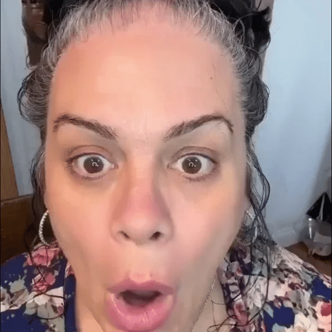 Relleno Capilar Instantáneo Calvicie