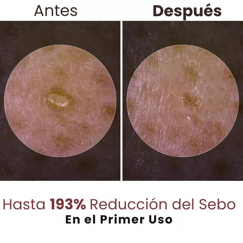 Exfoliante Esencia de Arroz Blanco o Negro | Hidratación Profunda y Suavidad