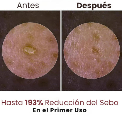 Exfoliante Esencia de Arroz Blanco o Negro | Hidratación Profunda y Suavidad
