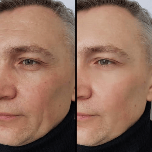 Retinal Elixir Nocturno Juventud Radiante