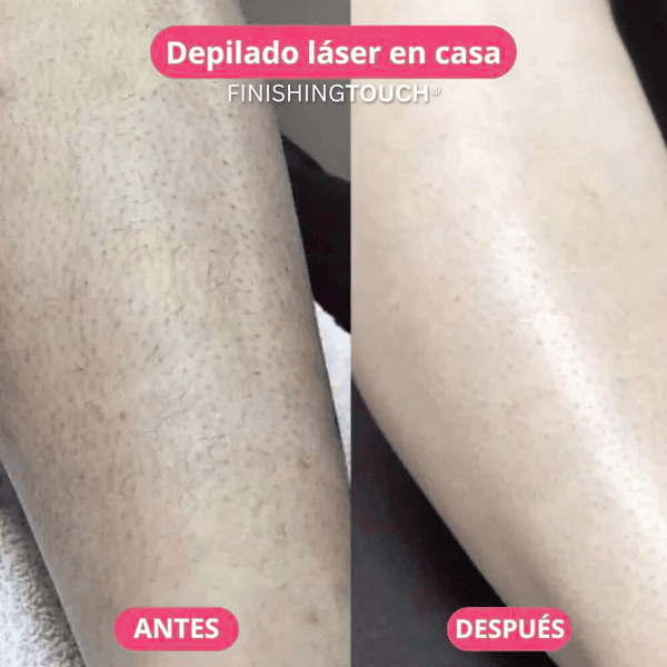 Depiladora Láser Sin Dolor