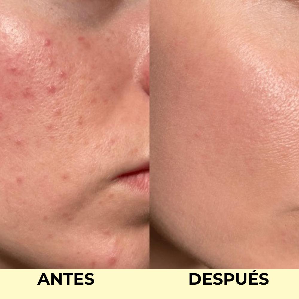 Bálsamo Luminoso para Piel